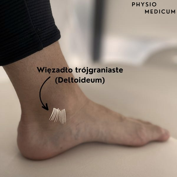 Uraz więzadeł w kostce – pierwsza pomoc i bezpieczny powrót do formy