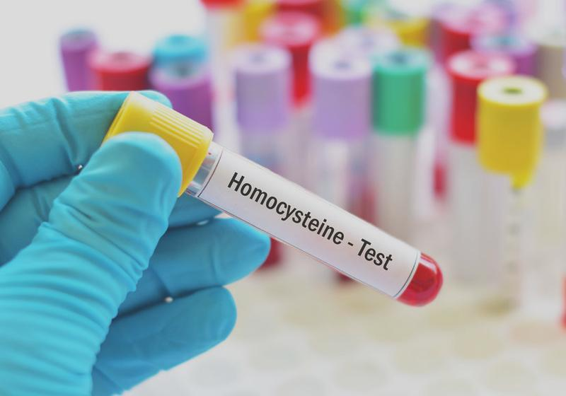 Homocysteina jako marker zdrowotny