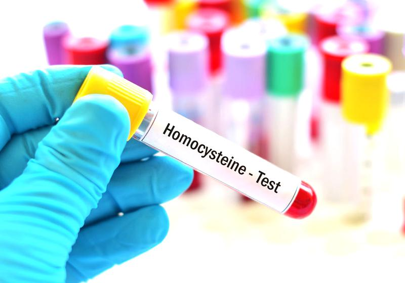 Jak interpretować wynik homocysteiny
