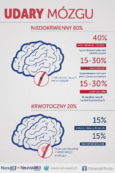 Przemijający atak niedokrwienny
