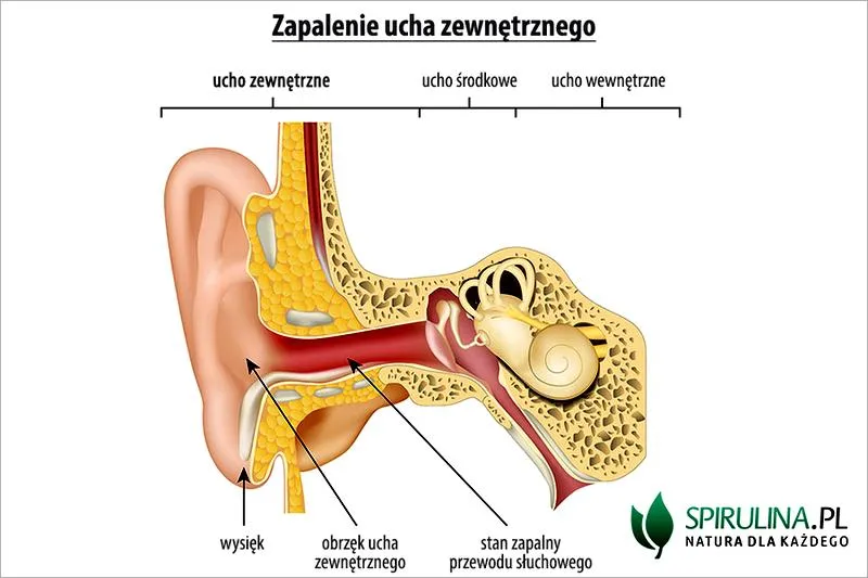 Przyczyny bólu ucha