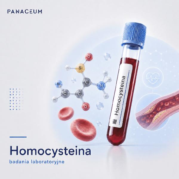 Przyczyny nadmiaru homocysteiny
